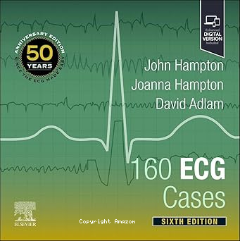 160 ECG Cases